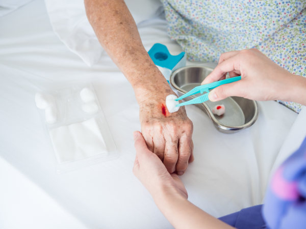 A picture of a nurses hand hold anothers hand while they clean a wound. There is a wound dressing tray on the bed.